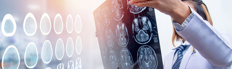Concussion Discussion